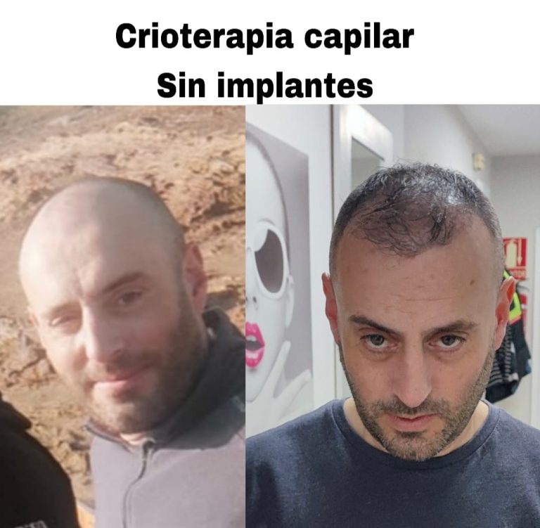 Caso Roberto