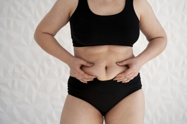 celulitis en el abdomen