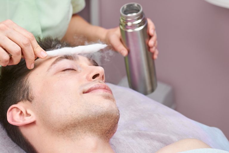 crioterapia capilar masculina