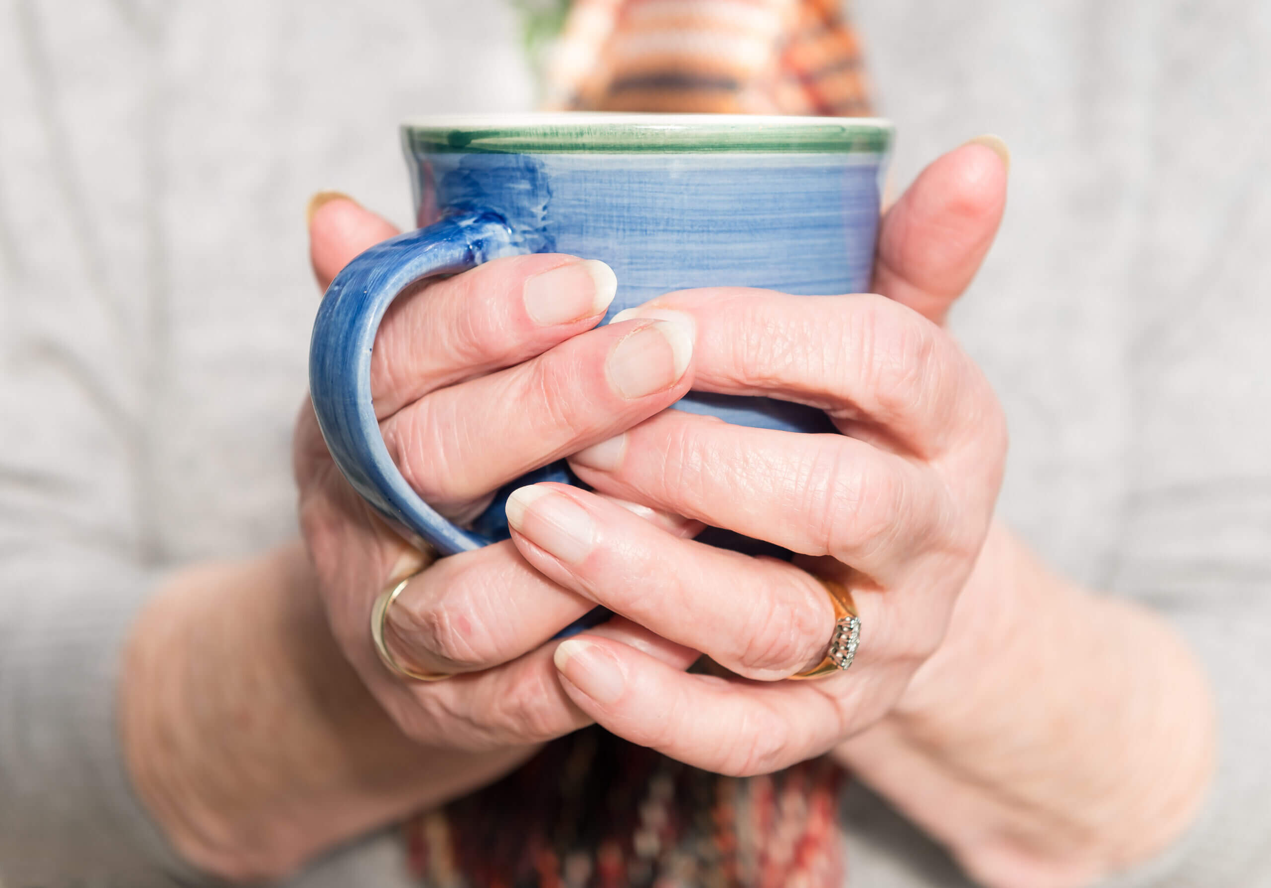 Manos frías sujetando taza caliente como señal de microcirculación periférica deficiente