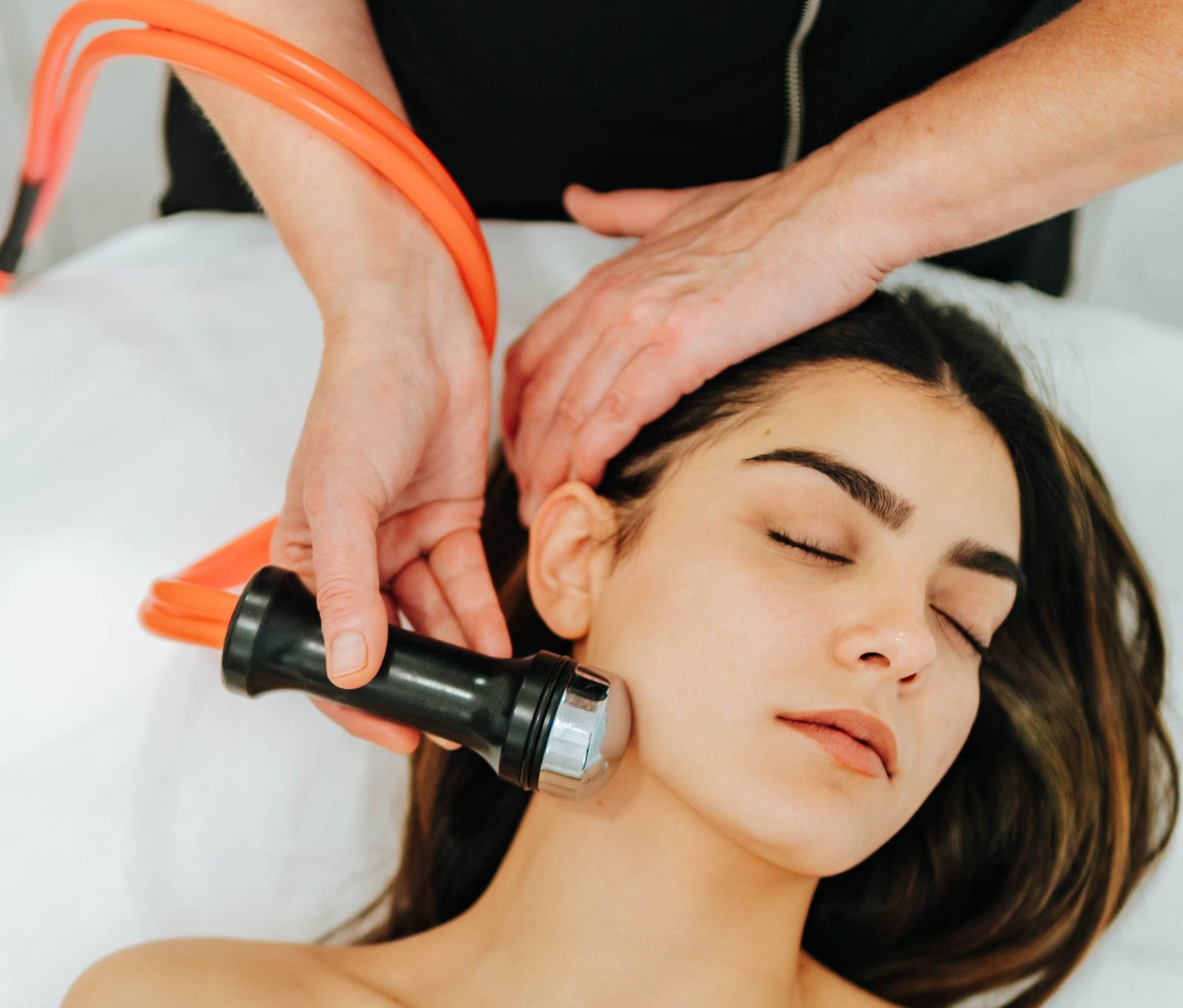 crioterapia para adolescentes con acné