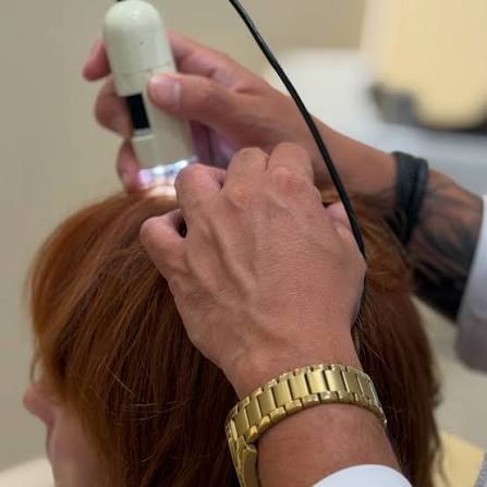 Consulta especializada de análisis capilar con tricoscopia para bailarines profesionales