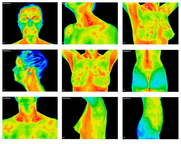 Imagen térmica del cuerpo mostrando distribución del calor corporal