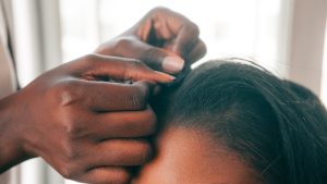 Exploración del cuero cabelludo en consulta a mujer en etapa de menopausia
