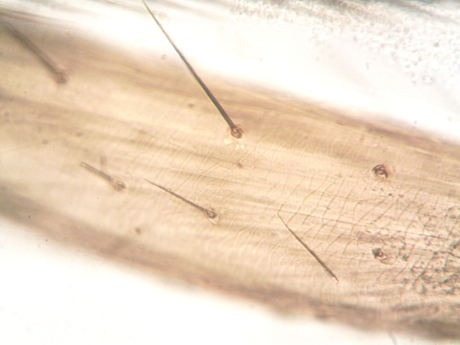 Imagen macro de cuero cabelludo con tallos de grosor desigual y salidas foliculares