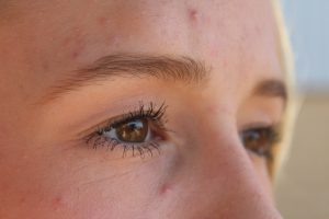Rostro con deshidratación cutánea visible tras el verano en clima continental seco